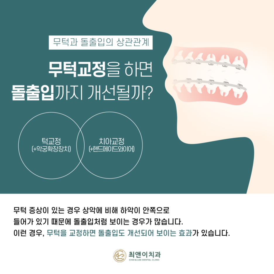 무턱 증상과 원인에 대해 관련 이미지 5