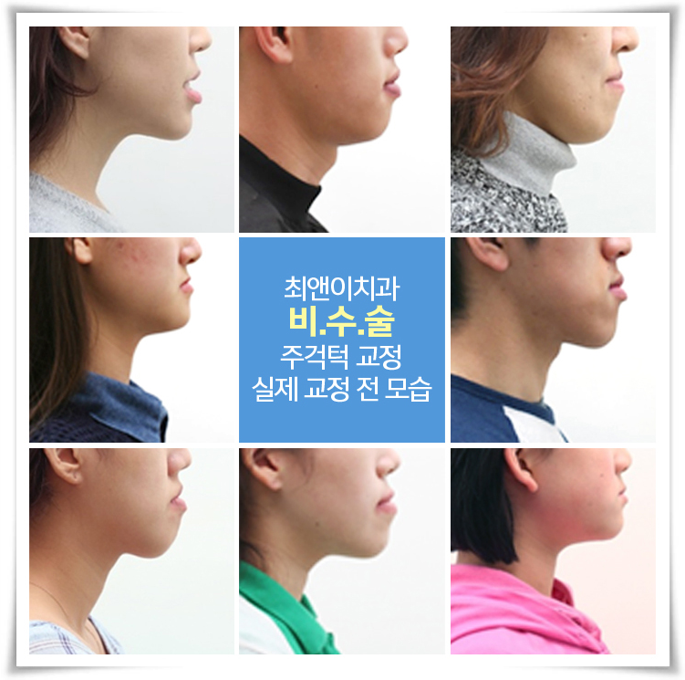 턱관절교정기 어울리는 방식으로 관련 이미지 4