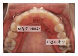 [치아교정] "치아교정과 치아 재교정" 방송일정~ 관련 이미지 4