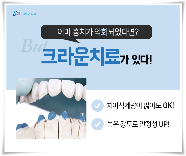 이빨부러짐 걱정은 이제 안녕 관련 이미지 8