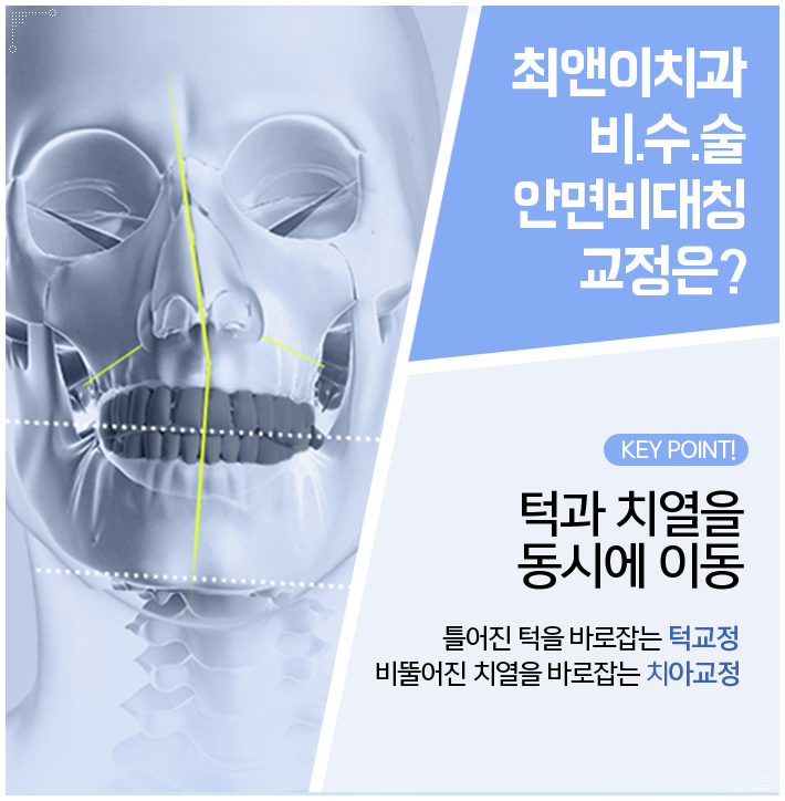 턱뼈비대칭 알맞게 잡아야죠 관련 이미지 6