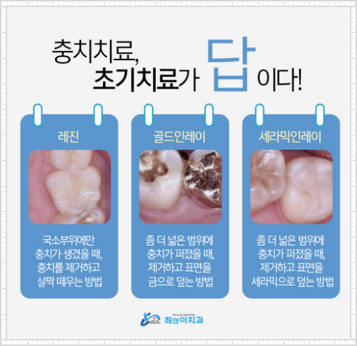 치아보존치료 늦으면 힘들어져요! 관련 이미지 7