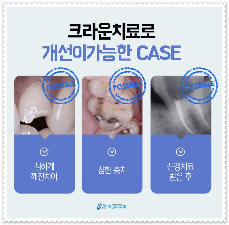 깨진 앞니 방치해도 괜찮을까? 관련 이미지 8