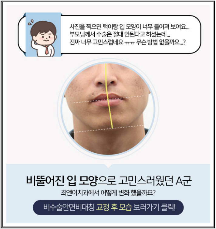 턱비대칭교정 근심이 줄어들도록 관련 이미지 7