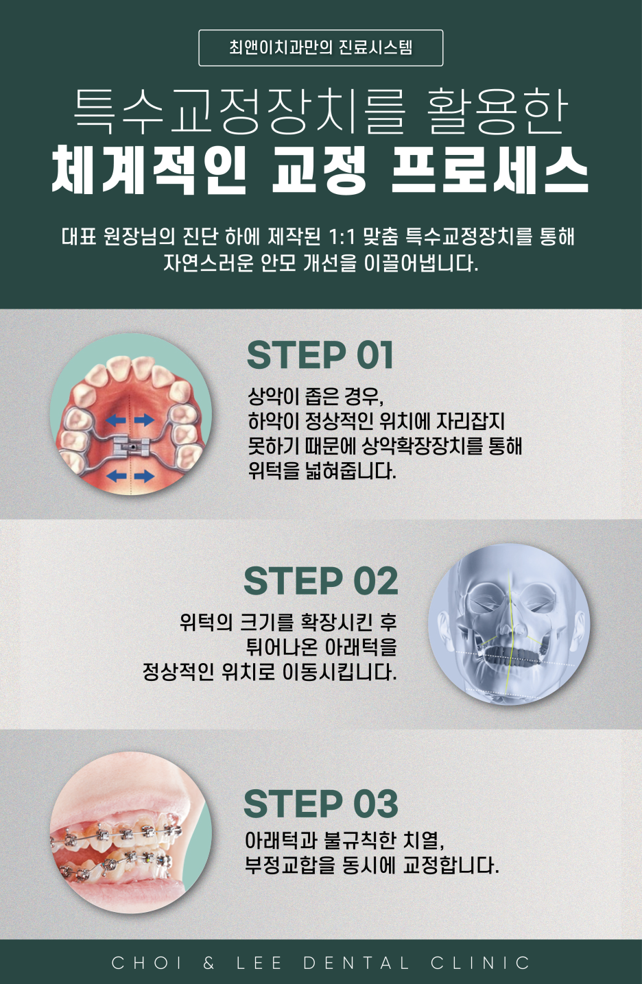 안면비대칭 증상과 원인에 대해 관련 이미지 6