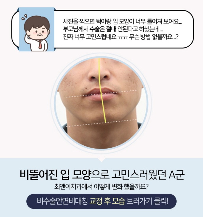 얼굴비대칭원인 알고자 한다면 관련 이미지 6