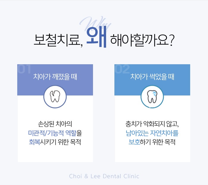 앞니브릿지잘하는곳 상황에 적합하도록 관련 이미지 3