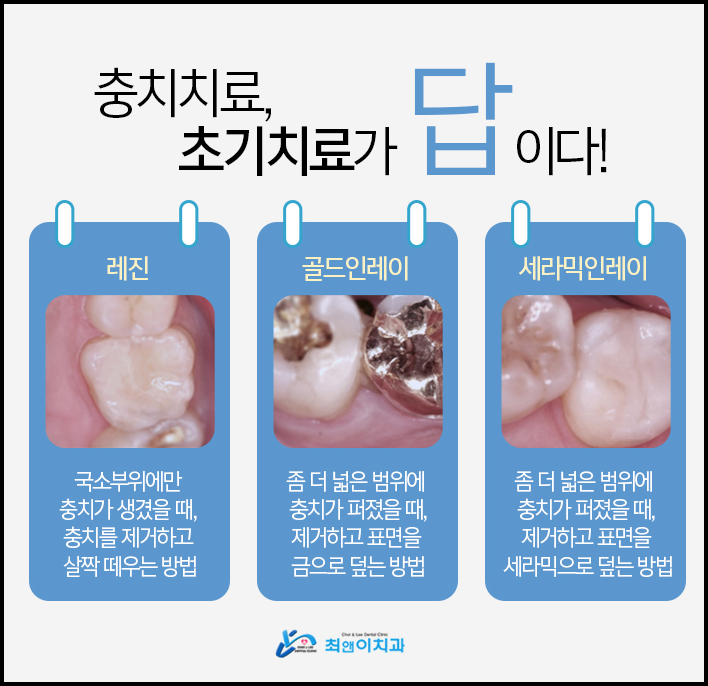 치아크라운가격 늦지 않도록 관련 이미지 7