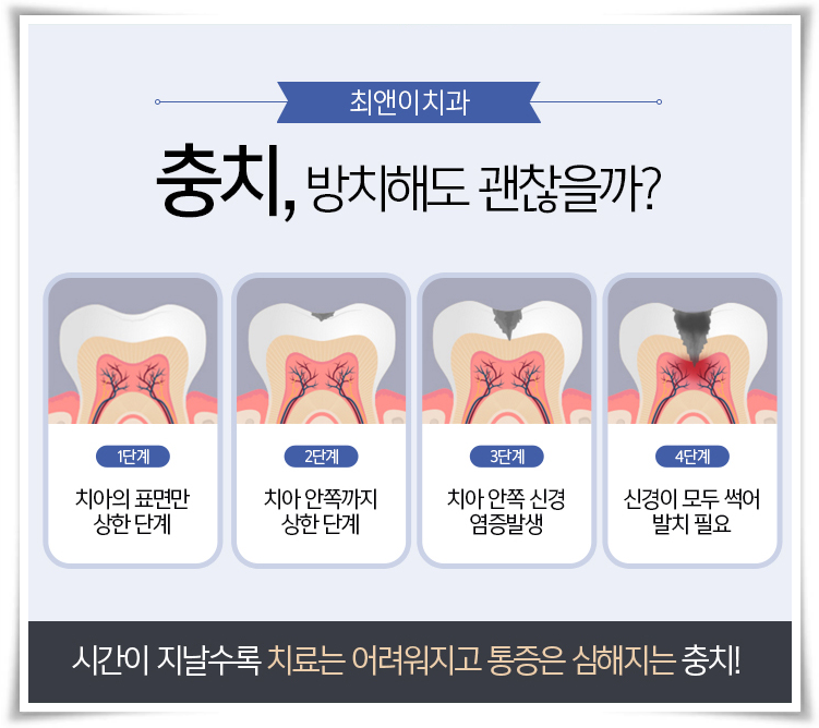 앞니충치치료 올바르게 알아보자 관련 이미지 8