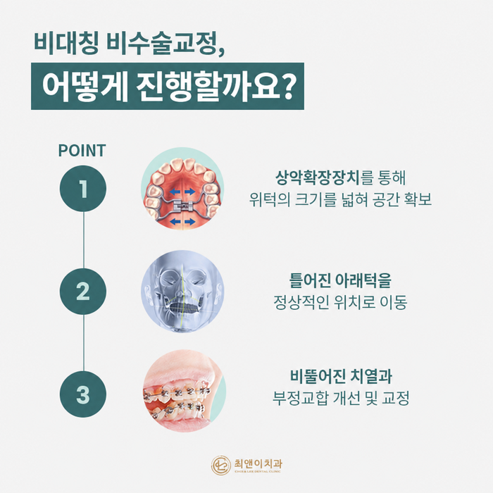 안면비대칭 증상과 원인에 대해 관련 이미지 6