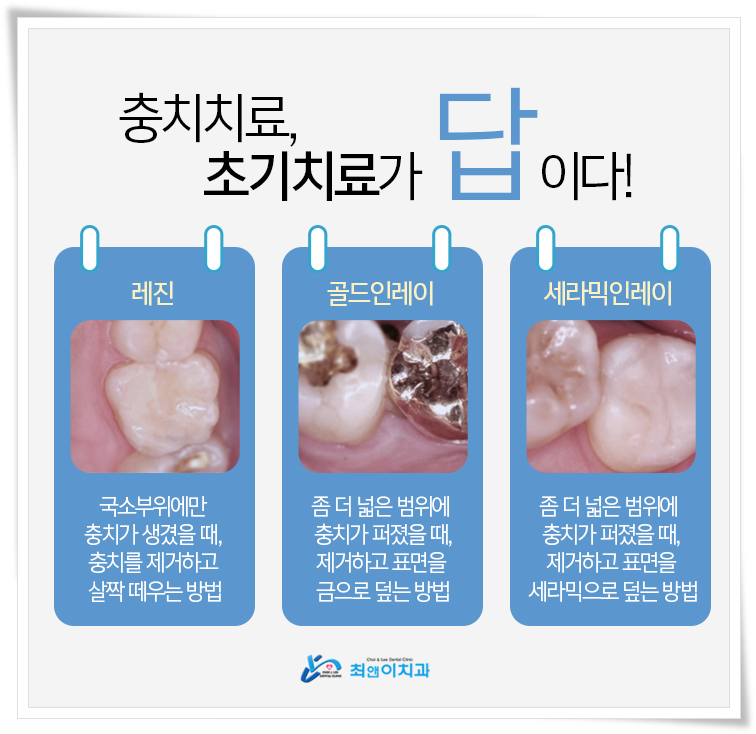 명동치과 아프지 않도록 하려면 관련 이미지 11