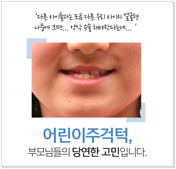 초등학생 치아교정 필요하다고 느끼나요? 관련 이미지 3