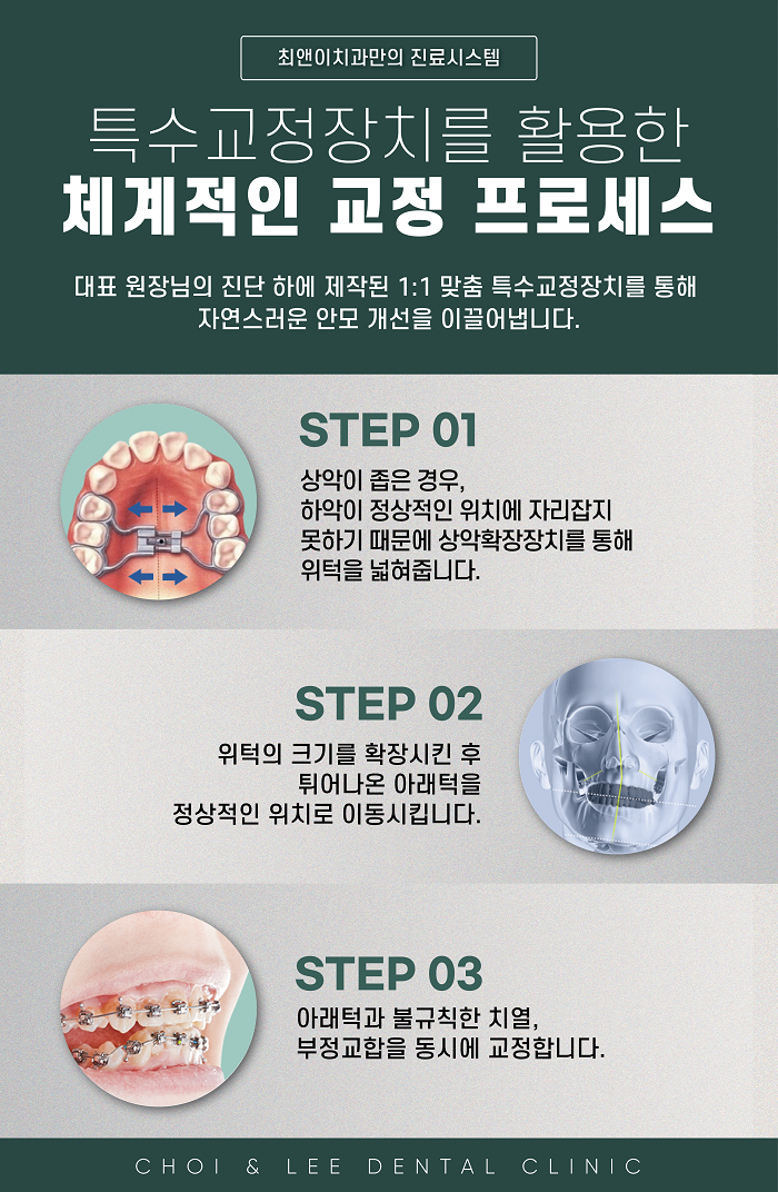 무턱 증상과 원인에 대해 관련 이미지 6