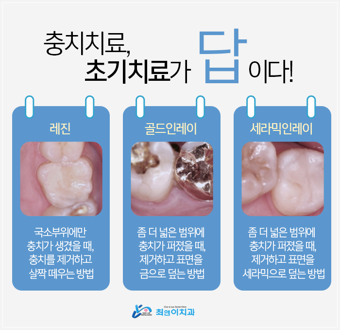 을지로입구역치과 나만을 위해서 관련 이미지 8