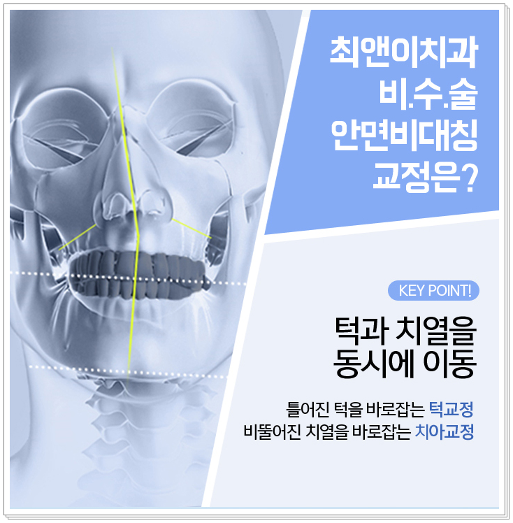 얼굴비대칭교정 비틀어져 보일 경우 관련 이미지 6