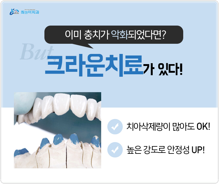 어금니깨짐 불편함이 있다면 관련 이미지 8