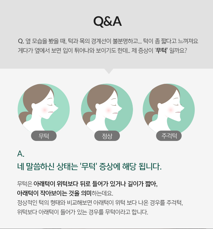 무턱 증상과 원인에 대해 관련 이미지 2