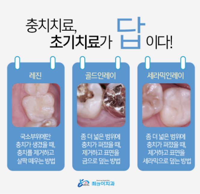 치아보철가격 찾아보고 있나요? 관련 이미지 7