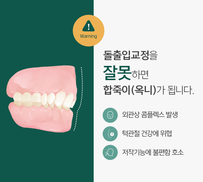 돌출입의 정의와 진단하는 방법에 대해 관련 이미지 4