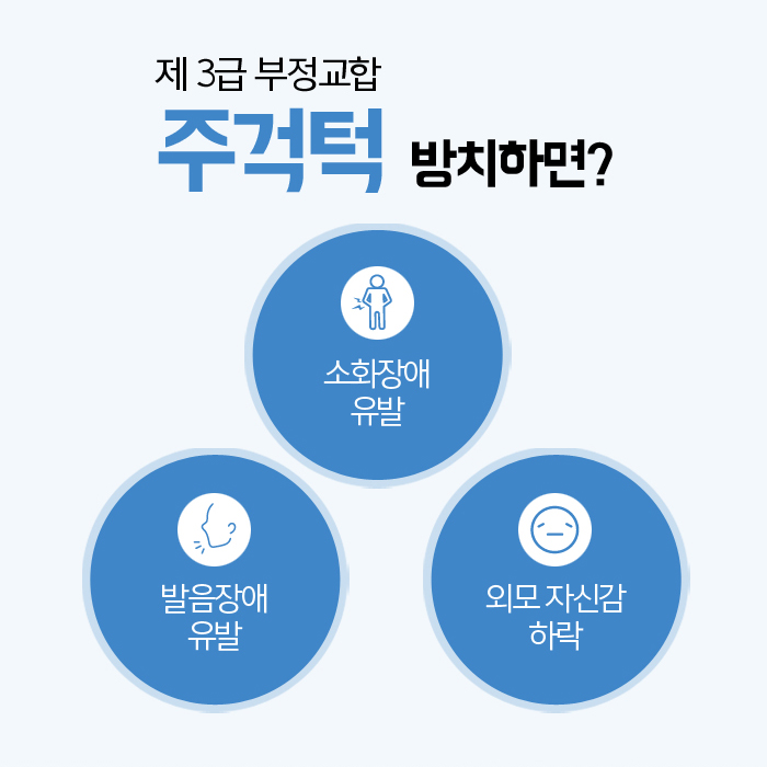 주걱턱의 정의와 증상에 대해 관련 이미지 3