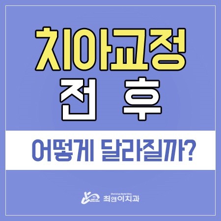 서울교정치과 필요에 따라서 관련 이미지 1