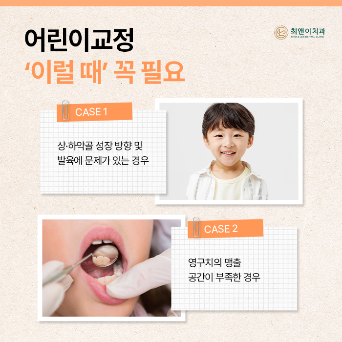 어린이교정 진행 방법에 대해 관련 이미지 3