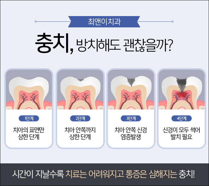 광화문치과 알맞은 방식 관련 이미지 7