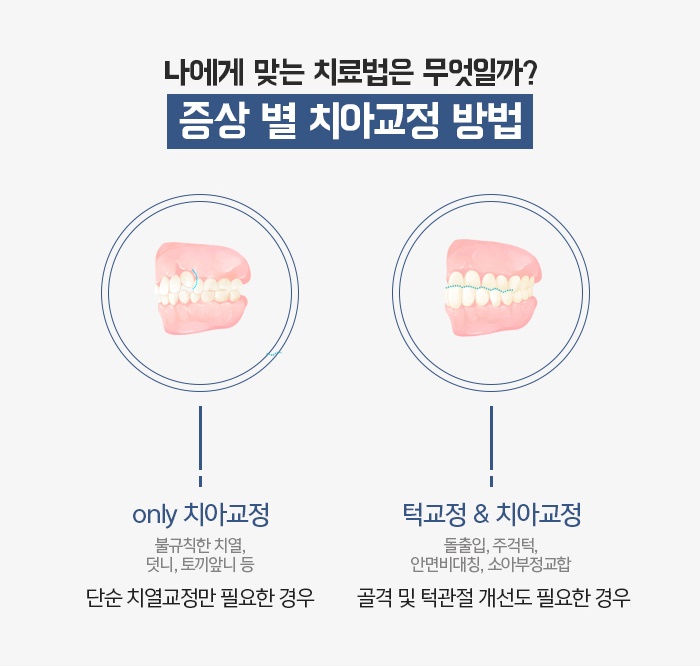 치아교정 목적과 치료 시 고려해야할 사항 관련 이미지 9