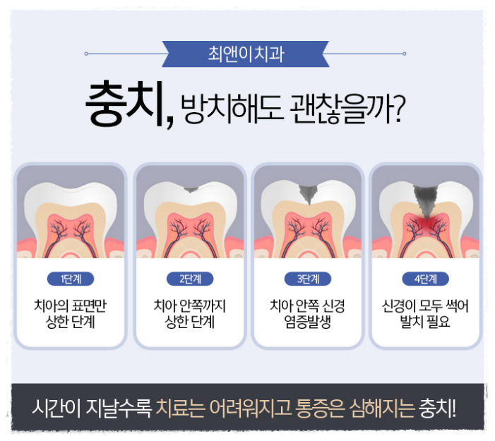 앞니부러짐 허전함이 크다면 관련 이미지 6