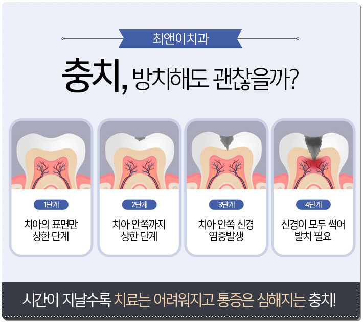 종각역치과 찾아보시면 관련 이미지 7