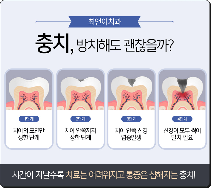 치과크라운비용 찾으시고 있다면? 관련 이미지 6