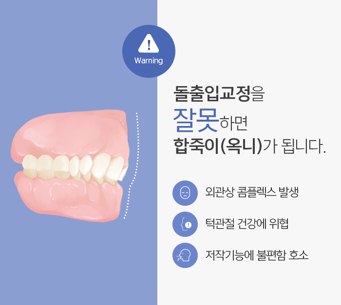 돌출입의 정의와 진단하는 방법에 대해 관련 이미지 4