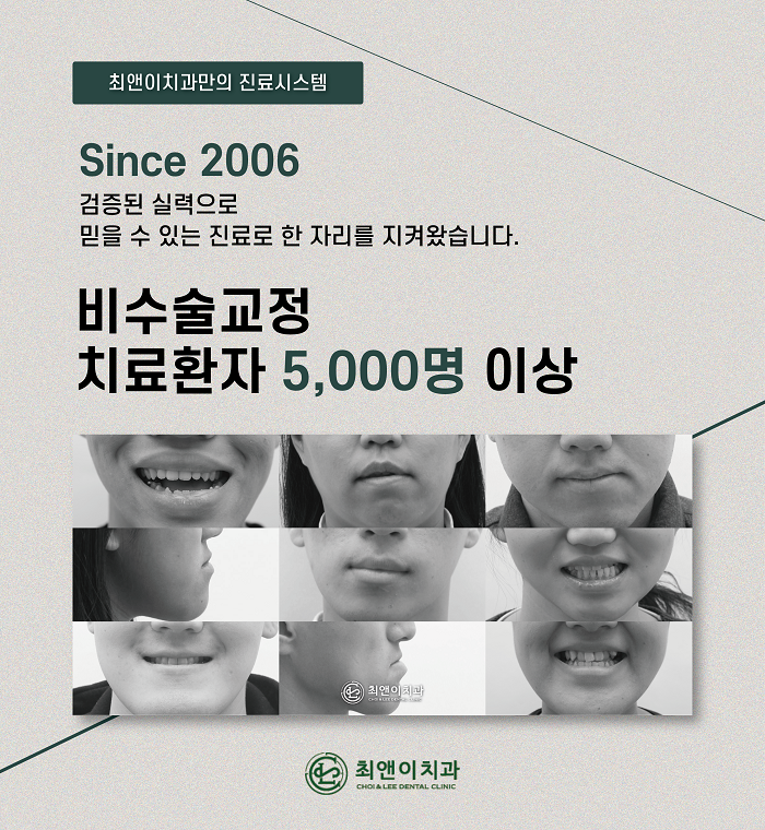 무턱 증상과 원인에 대해 관련 이미지 11