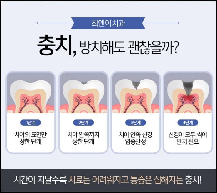 종로치과 먼 곳을 찾기 보다 관련 이미지 7