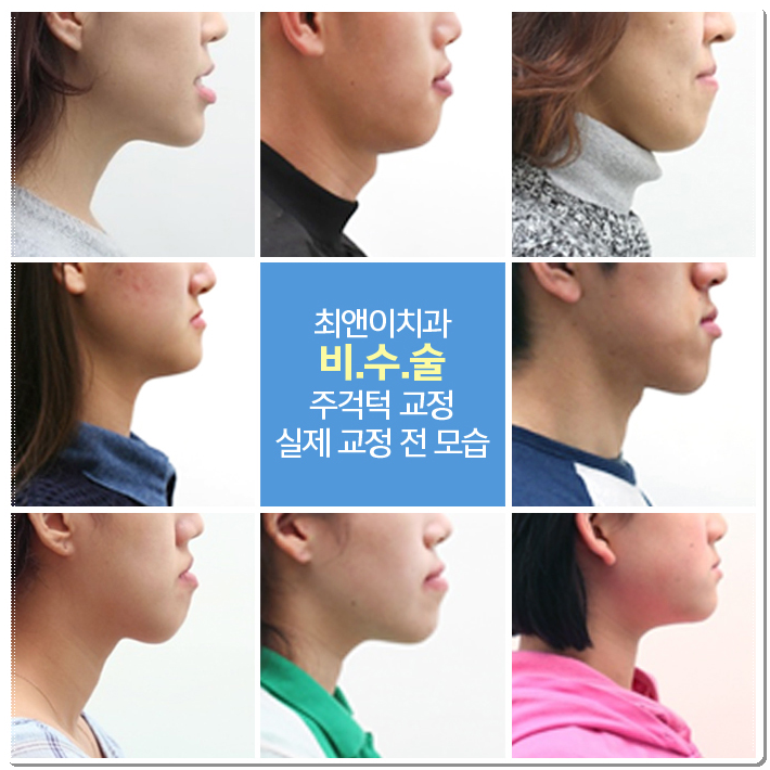 을지로치아교정 곰곰이 생각하면 관련 이미지 3