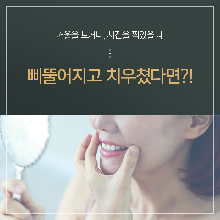 안면비대칭 증상과 원인에 대해 관련 이미지 2