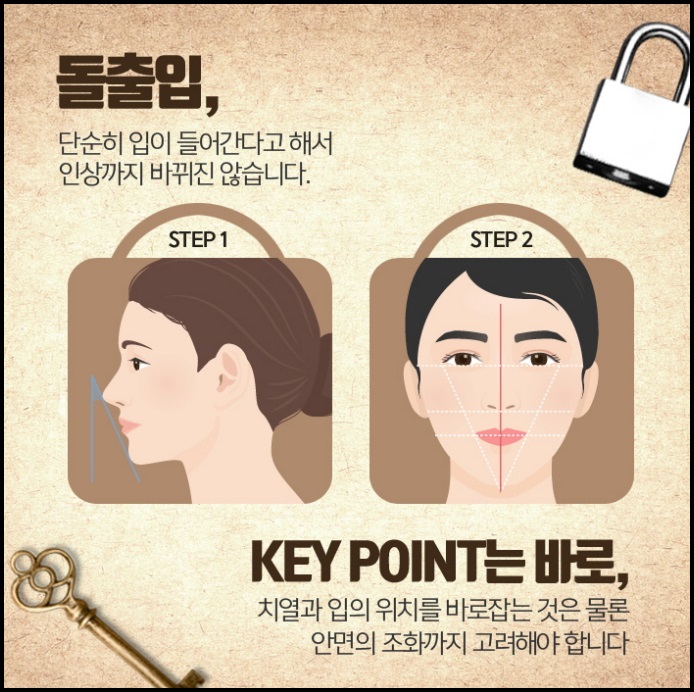 돌출입교정비용 불편하지 않도록 관련 이미지 6