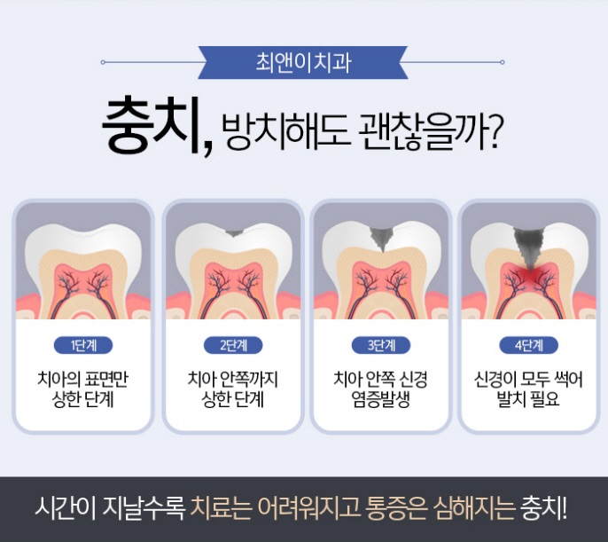 레진 치료 비용 힘들지 않도록 관련 이미지 4