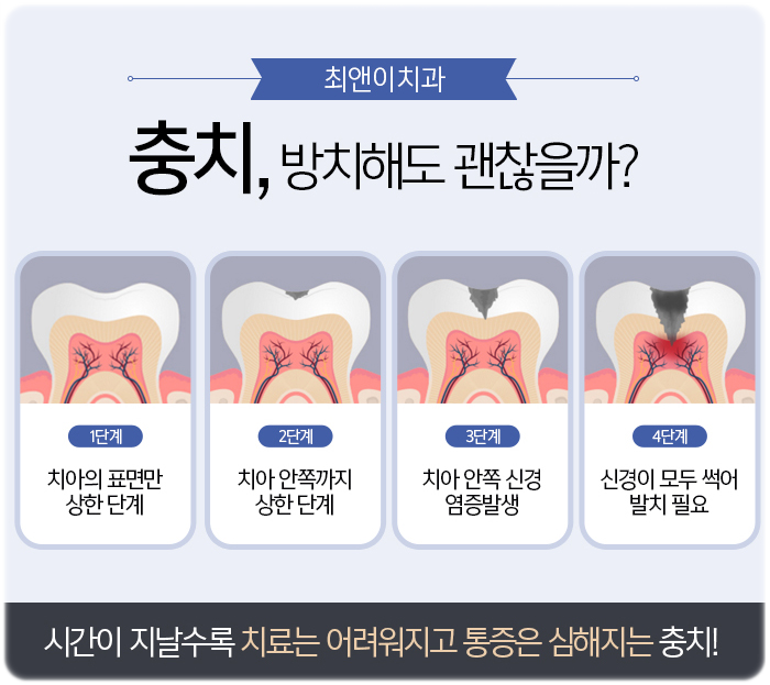 이빨깨졌을때 어쩔줄 모른다면? 관련 이미지 6