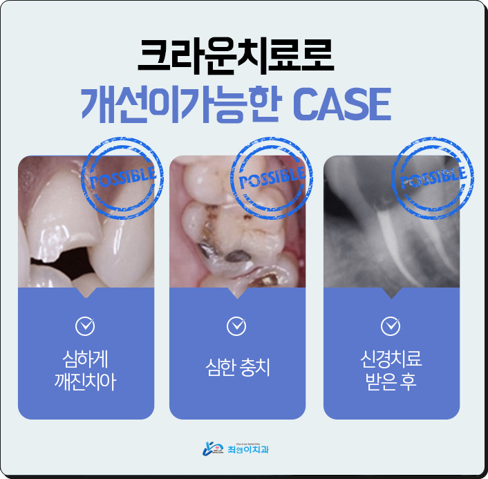 치과크라운비용 찾으시고 있다면? 관련 이미지 9