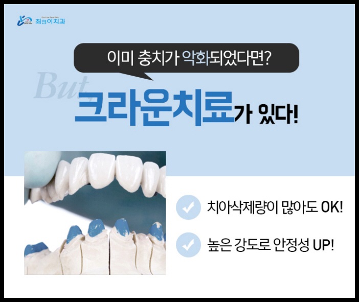 크라운치료가격 힘들지 않아야죠 관련 이미지 5