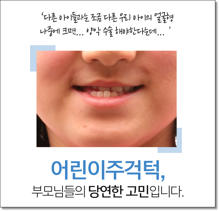 어린이주걱턱 구성부터 따져봐요 관련 이미지 2