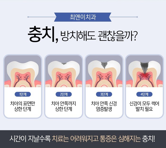 충치레진치료 아픔이 줄어들도록 관련 이미지 6