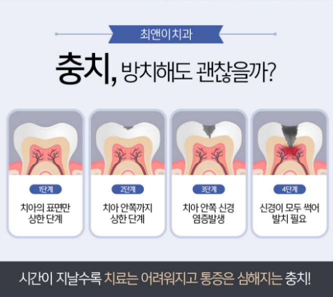 치아보철가격 찾아보고 있나요? 관련 이미지 6