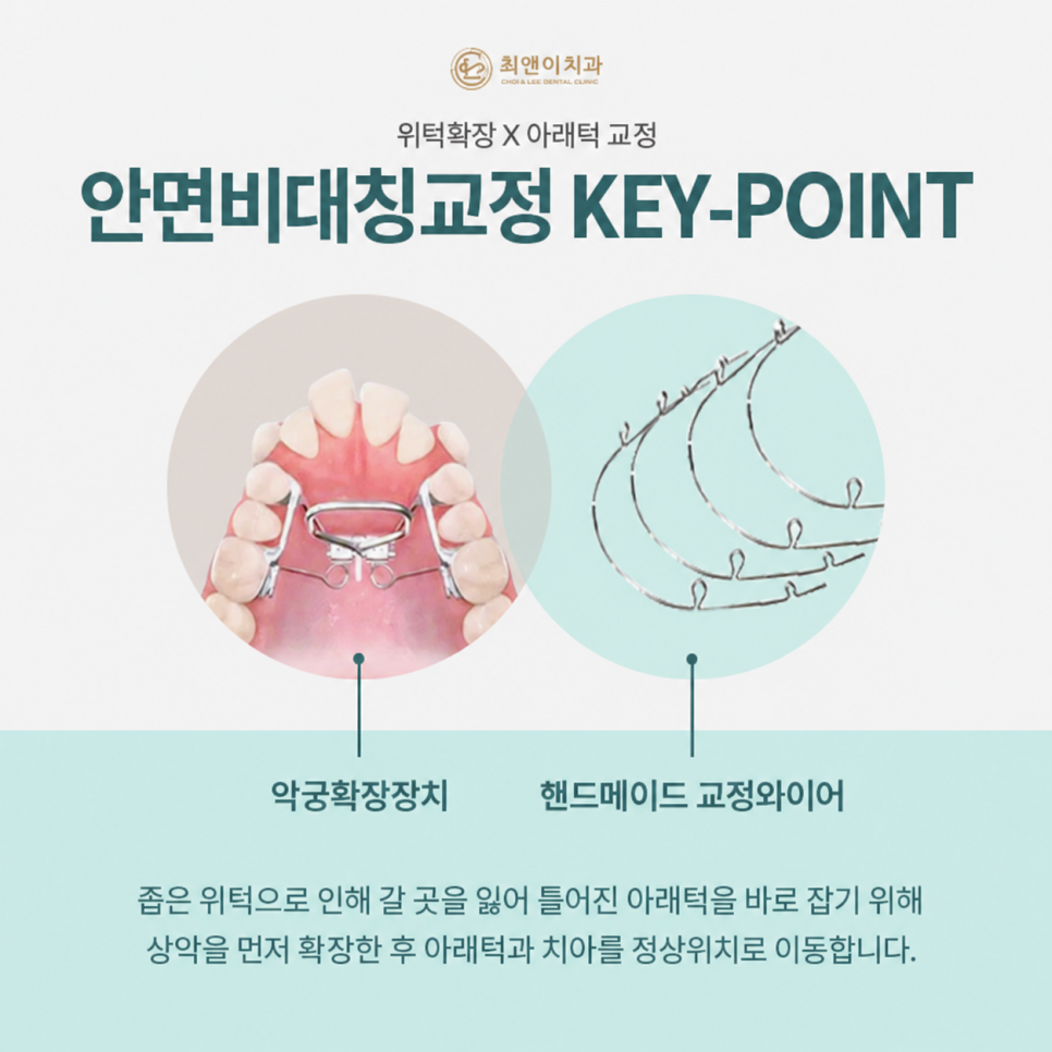 안면비대칭 증상과 원인에 대해 관련 이미지 7