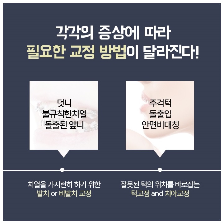 덧니부분교정 힘들지 않도록 관련 이미지 3