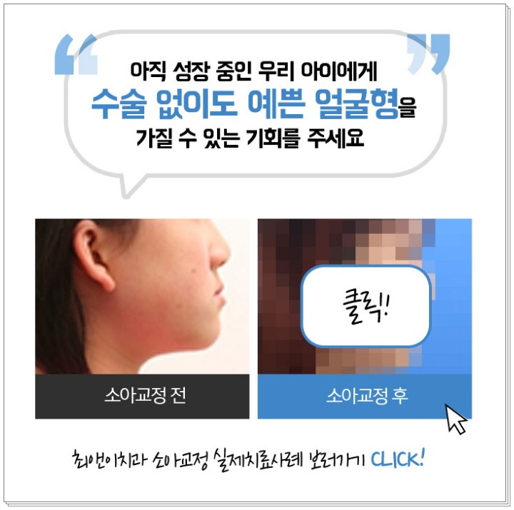초등학생 치아교정 필요하다고 느끼나요? 관련 이미지 5