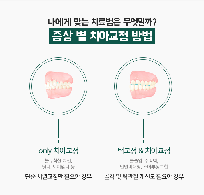치아교정 목적과 치료 시 고려해야할 사항 관련 이미지 9