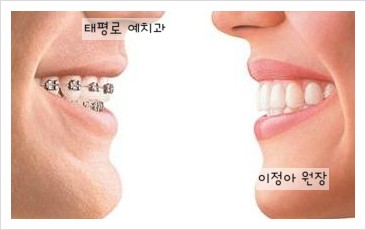 [in 치아교정과] 2월 치아교정 & 설측교정 방송일정 관련 이미지 1
