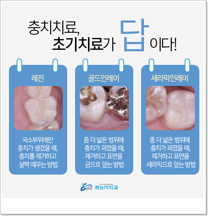 종각치과 무엇이 다를까? 관련 이미지 8